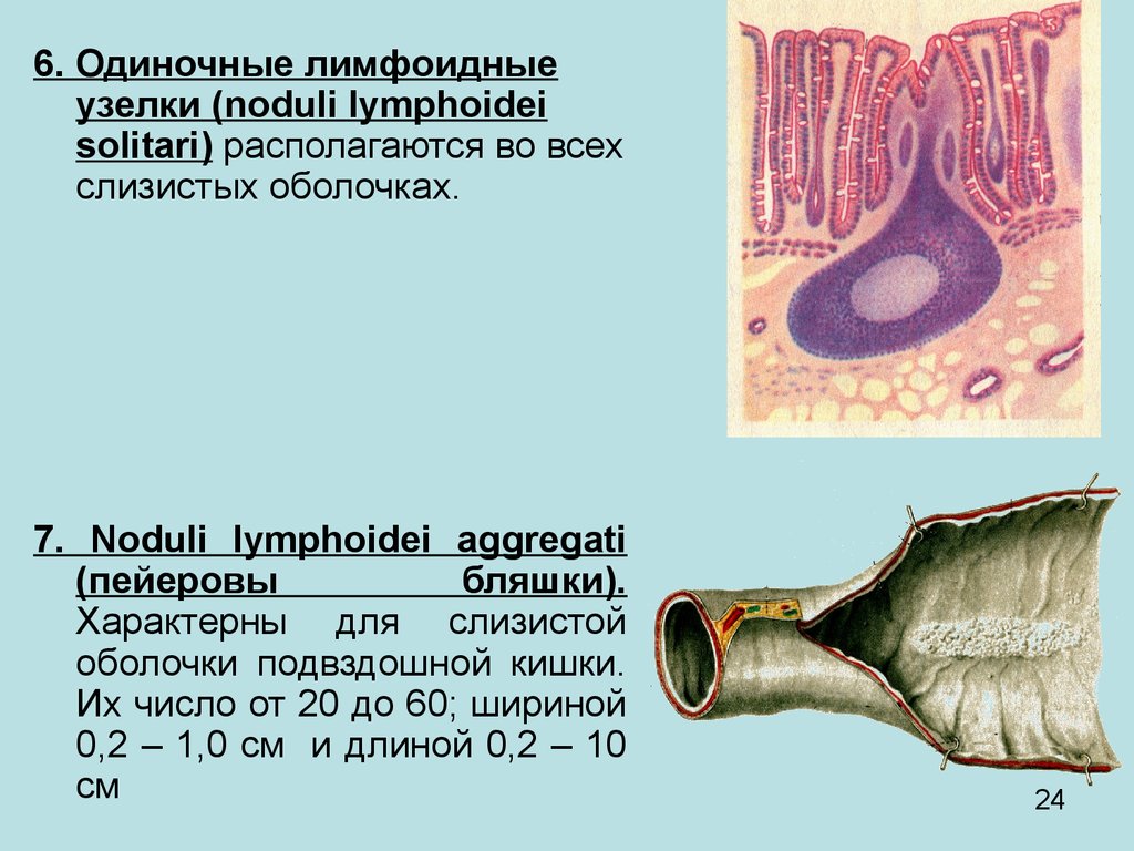 Пейеровы бляшки