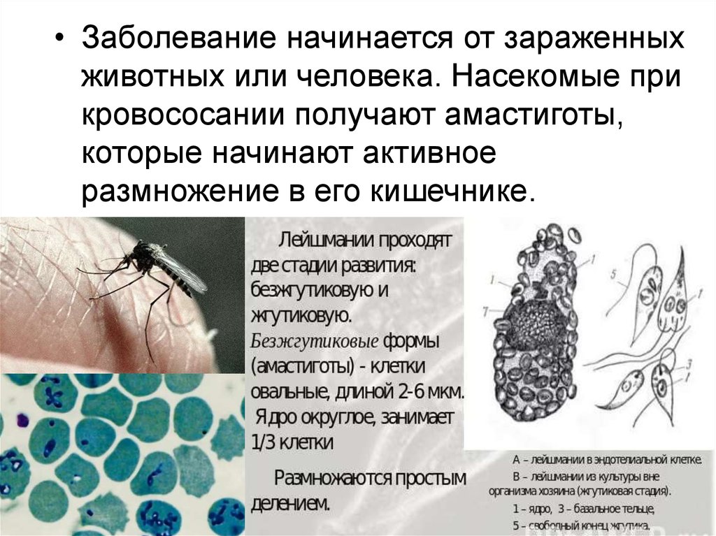 Протозойные инфекции это