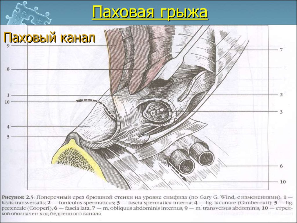 Паховый канал анатомия у мужчин схема