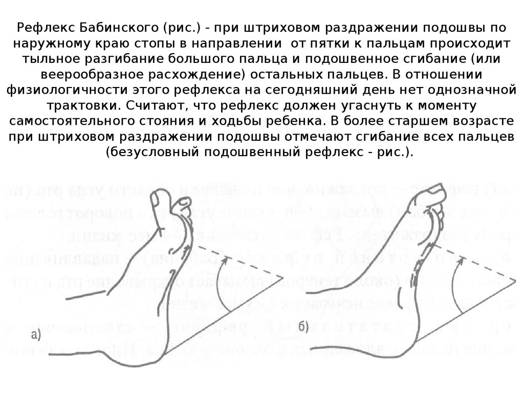 Подошвенное сгибание стопы