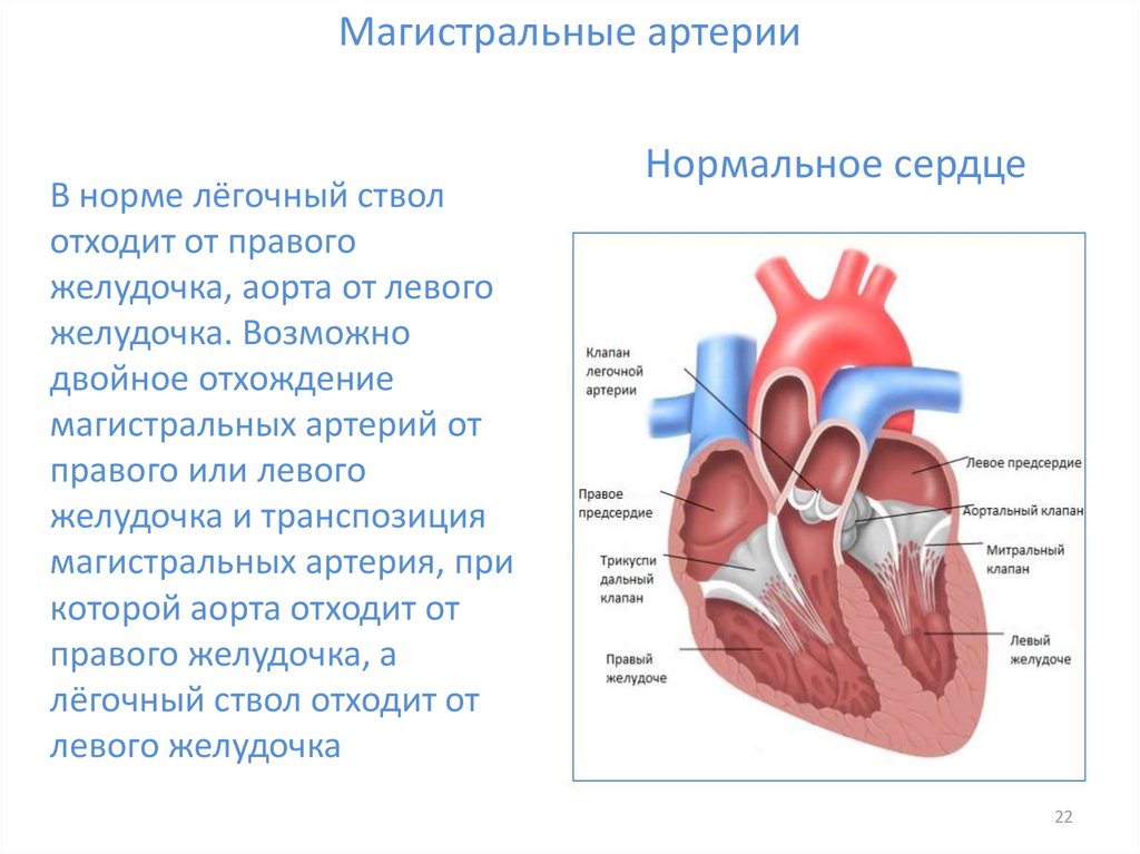 Клапан легочной артерии. Сочетанные и комбинированные пороки сердца. Сердце аорта легочный ствол. Легочный ствол на аортальном клапане. Комбинированный аортальный порок сердца.