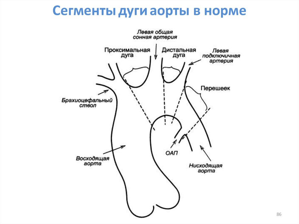 Сегменты подключичной артерии схема