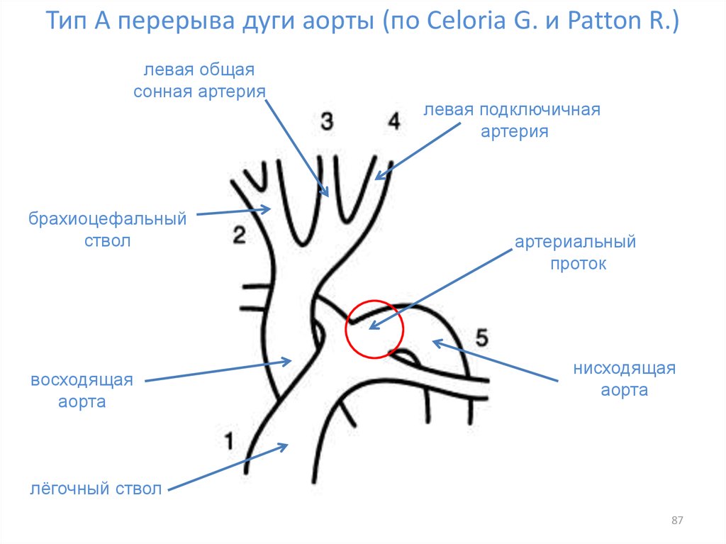 Ствол дуги аорты