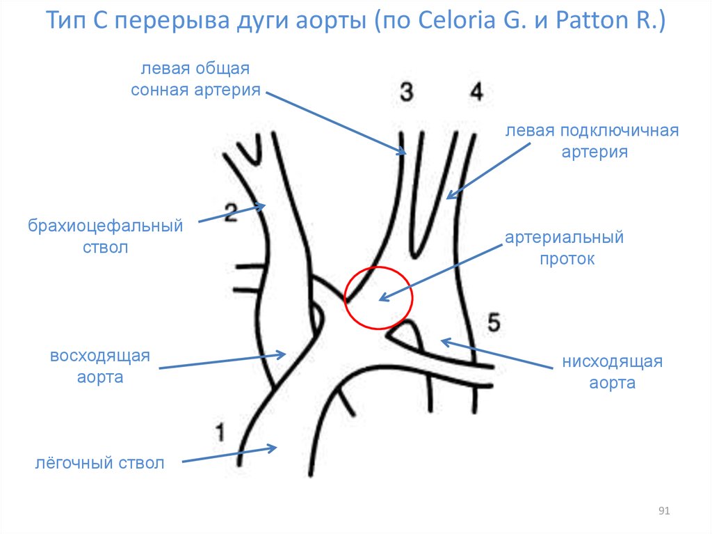 Ствол дуги аорты