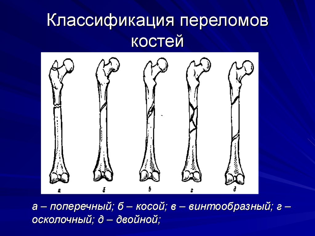 Презентации на тему переломы