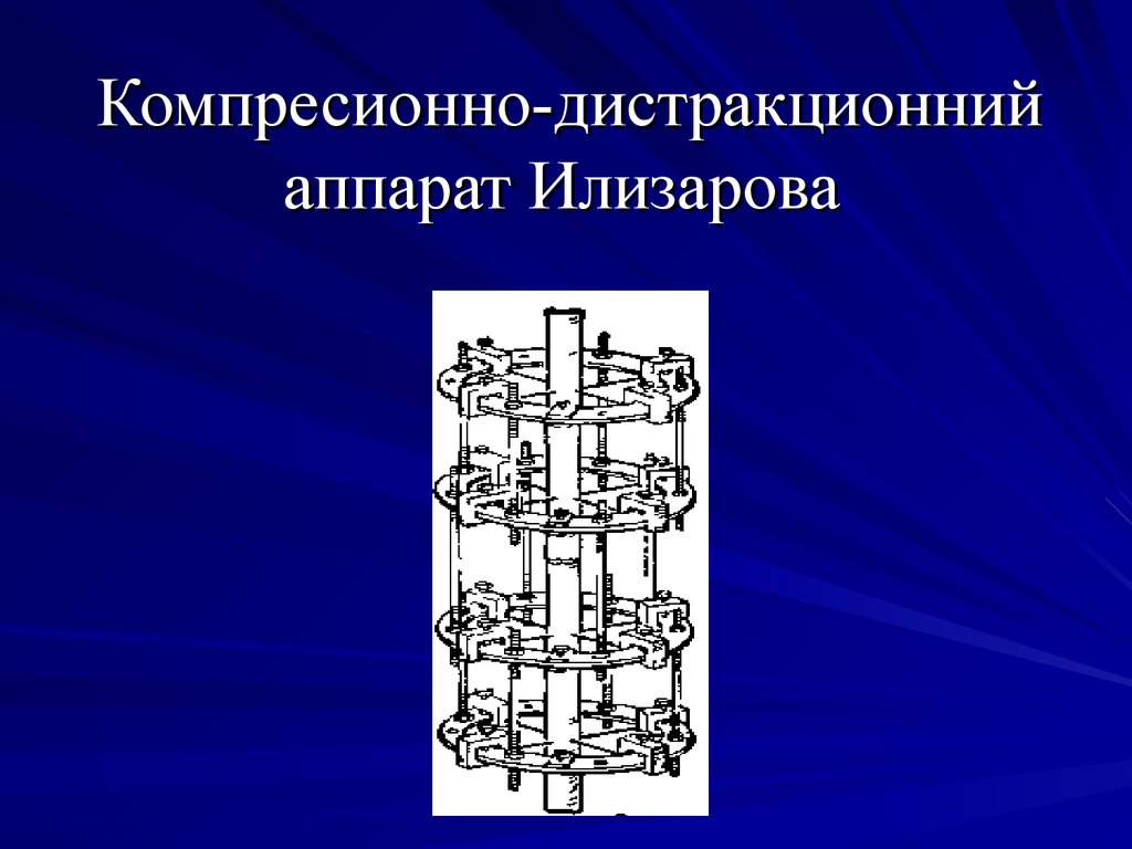 Схема центра илизарова