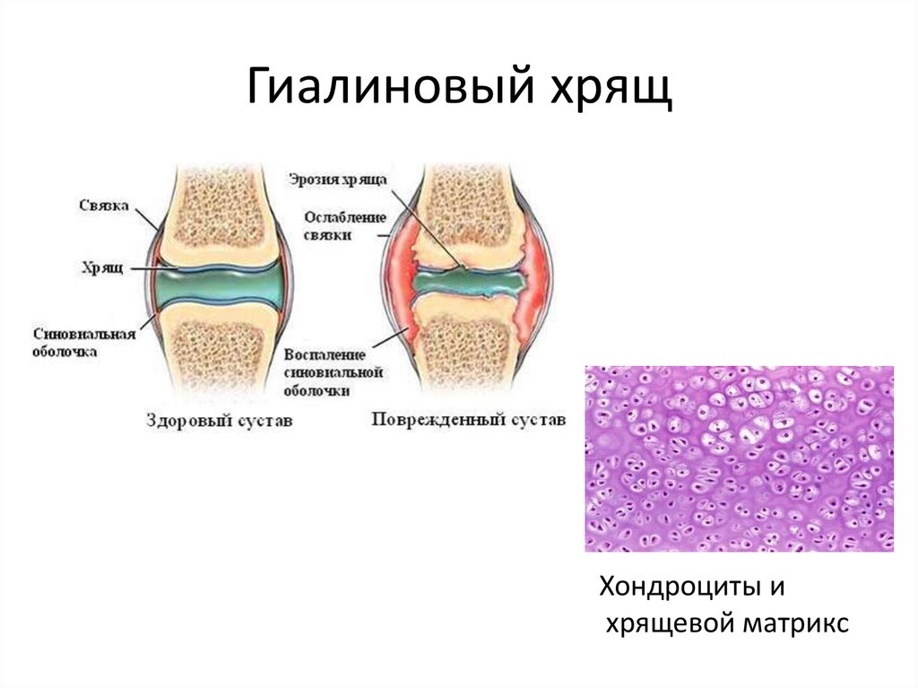 Гиалиновый хрящ нарисовать