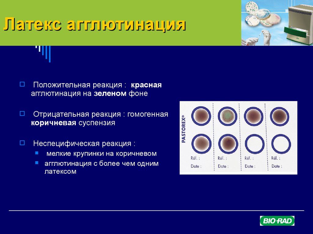 Положительная реакция. Реакция латекс агглютинации компоненты. Реакция латекс агглютинации. Основные компоненты.. Реакция латекс агглютинации схема. Метод латекс агглютинации микробиология.