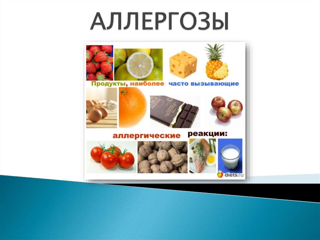 Аллергоз. Презентация аллергозы. Острые аллергозы. Аллергозы типы. Аллергозы это группа заболеваний.