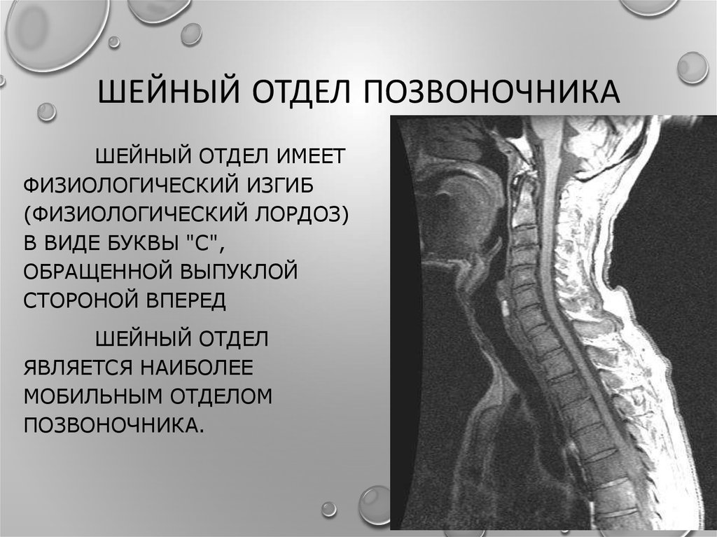 Позвонки шейного отдела. Шейный отдел позвоночника. Шейный отдел позвоночника анатомия. Строение шейного отдела.