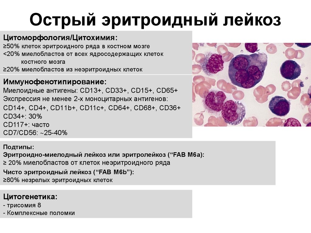 Рак крови диагнозы
