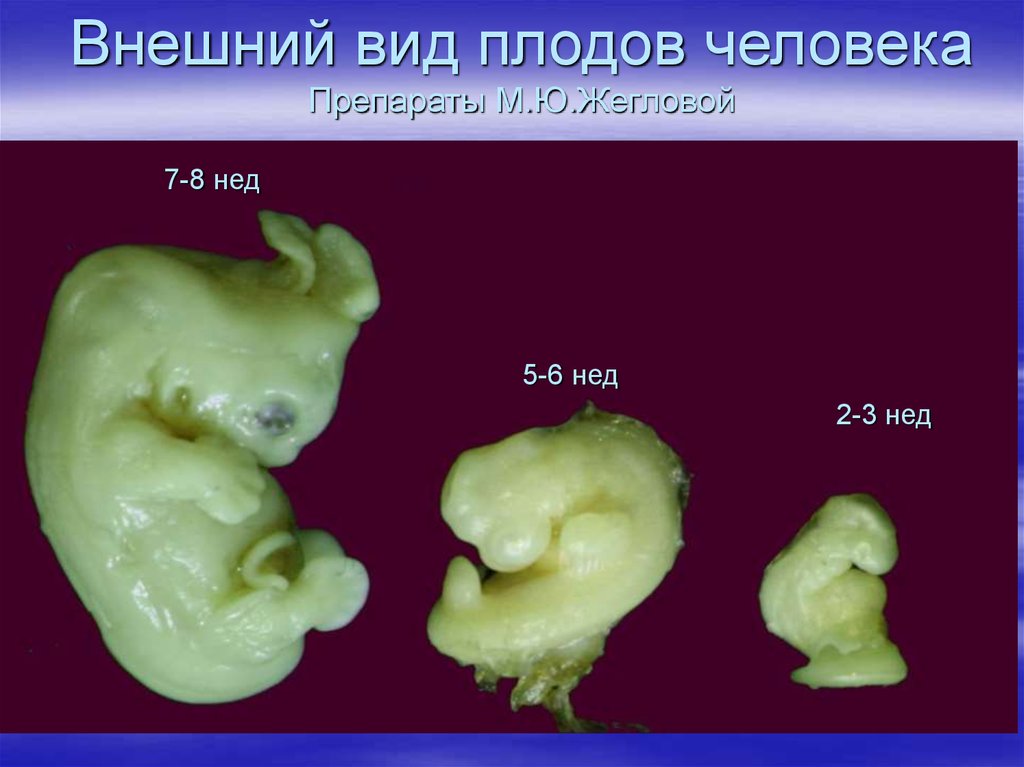 Почему эмбрионы. Внешний вид плода человека. Форма зародыша у человека. Эмбрион человека 2 недели.