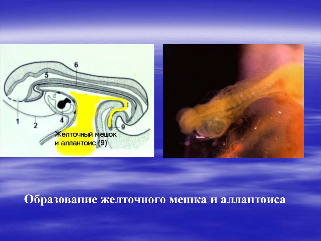 Желточный мешок. Образование желточного мешка. Желточный мешок строение. Желточный мешок у человека. Желточный мешок образование строение функции.