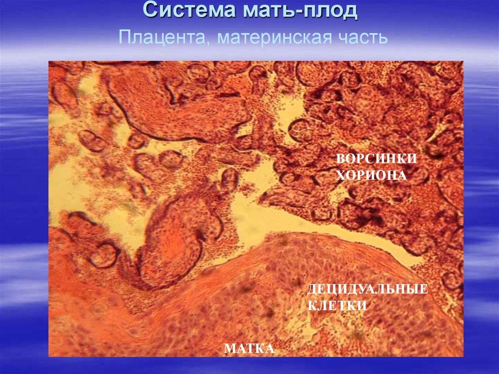 Система мама. Децидуальная оболочка материнской части плаценты. Система мать плацента плод гистология. Плацента материнская часть ворсинки хориона. Плацента человека материнская часть.