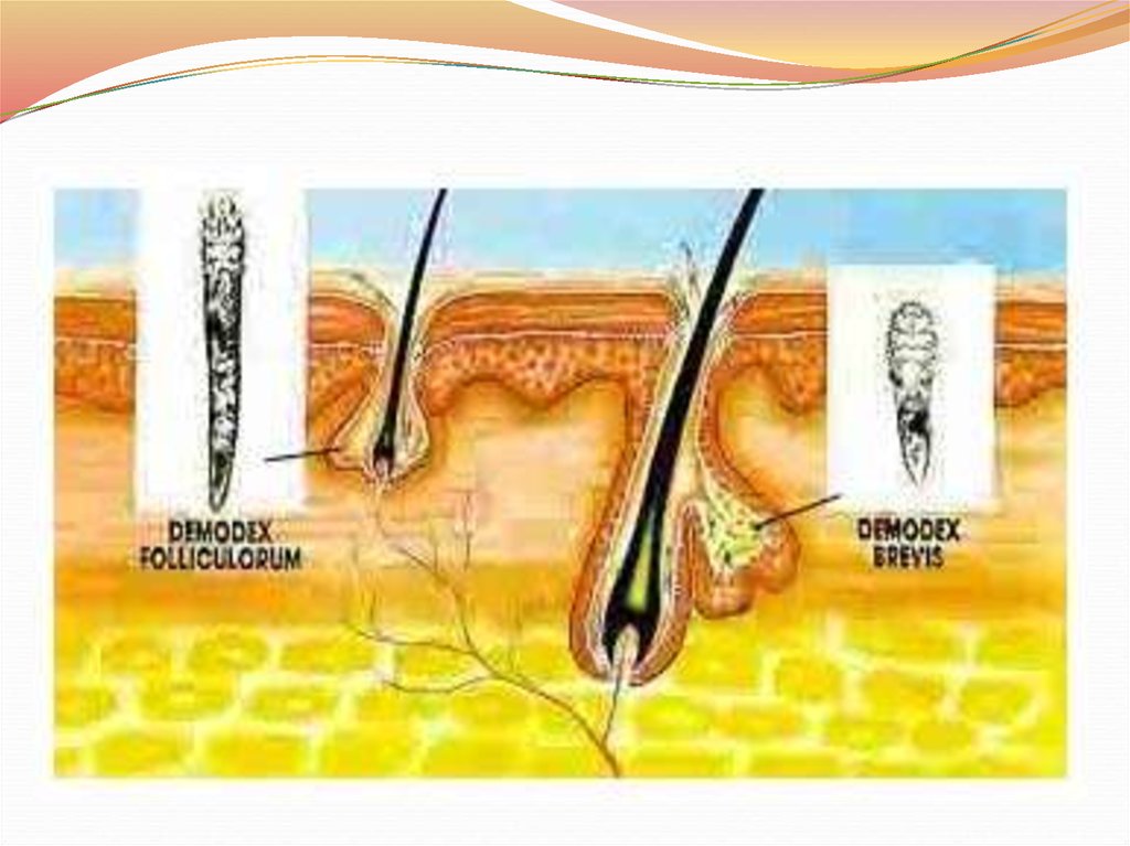 Демодекс лечение. Клещи сальных желез рода демодекс.. Клещ демодекс фолликулорум. Demodex folliculorum под микроскопом.