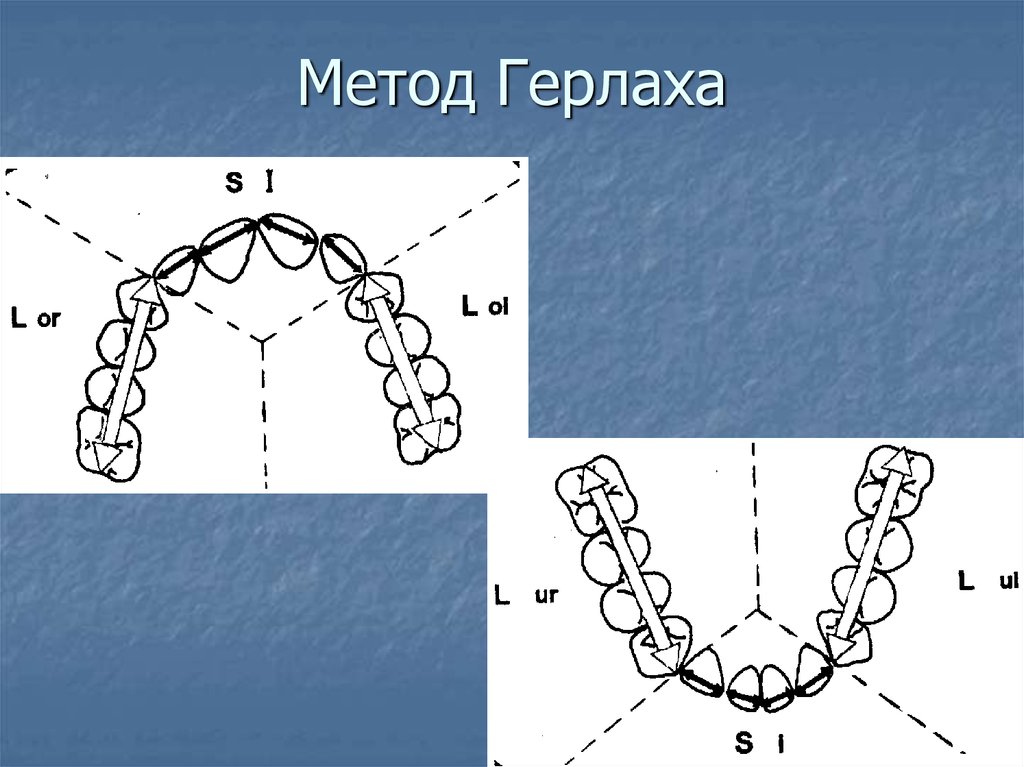 Диаграмма хаулея гербера гербста