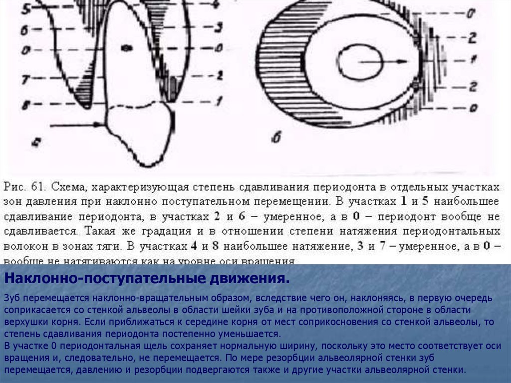 Зона давления. Наклонно-вращательное движение зуба. Наклонно-поступательное перемещение зубов. Зону давления и зону натяжения зуба. Зоны натяжения и давления ортодонтического.