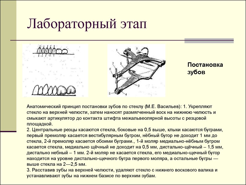 Постановка зубов по васильеву по стеклу презентация