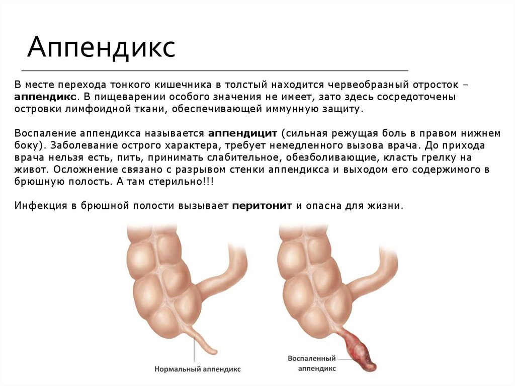 Аппендикс расположение схема