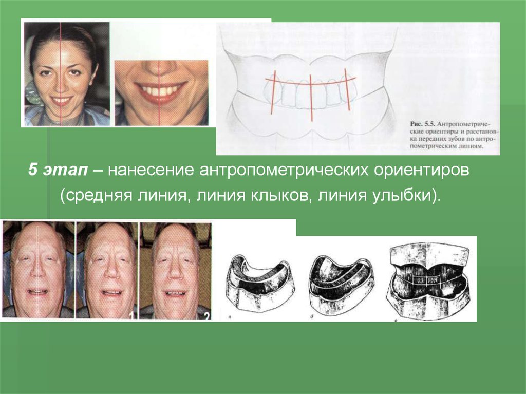 Центральная окклюзия и центральное соотношение челюстей презентация