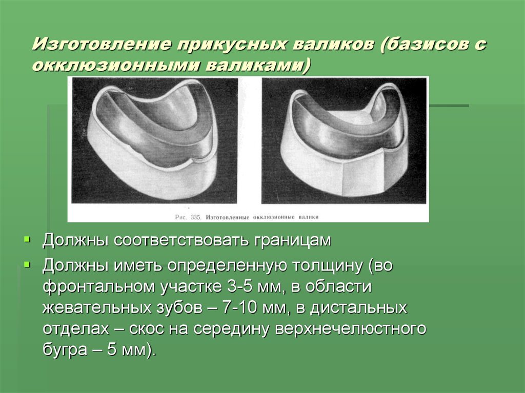 Базис схема стыка некорректна