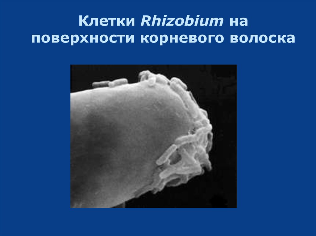 Клетки Rhizobium на поверхности корневого волоска