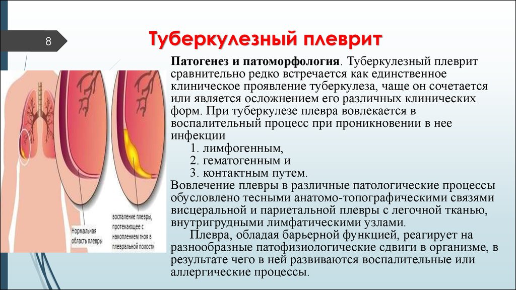 Туберкулезный плеврит презентация