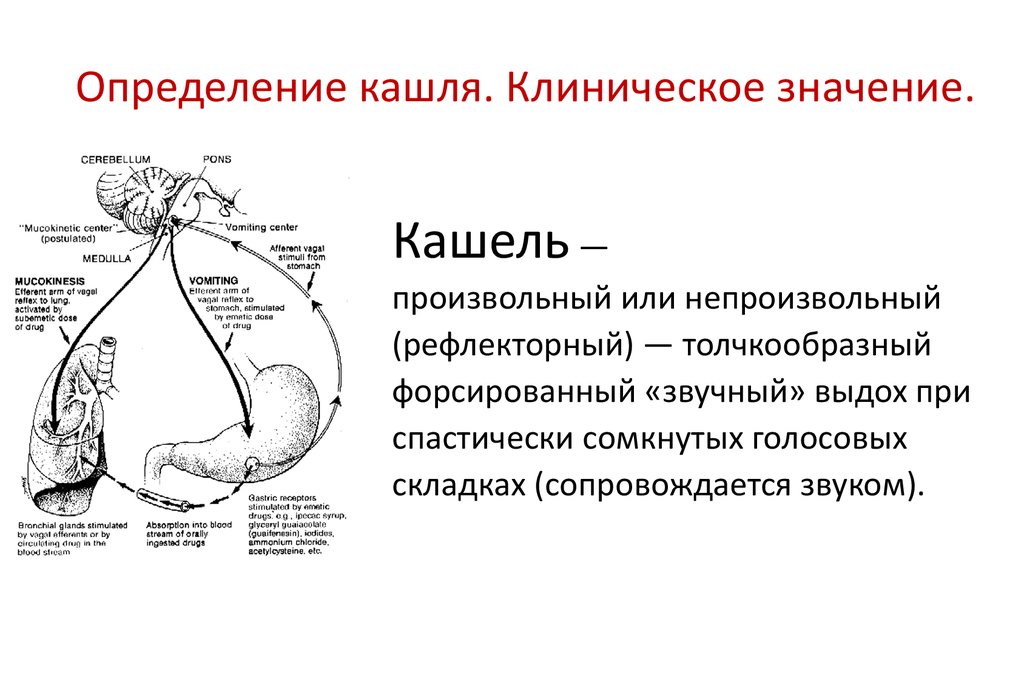 Механизм действия кашля. Механизм возникновения кашля. Кашлевой рефлекс физиология. Кашлевой рефлекс схема физиология. Физиология кашля механизм кашля.