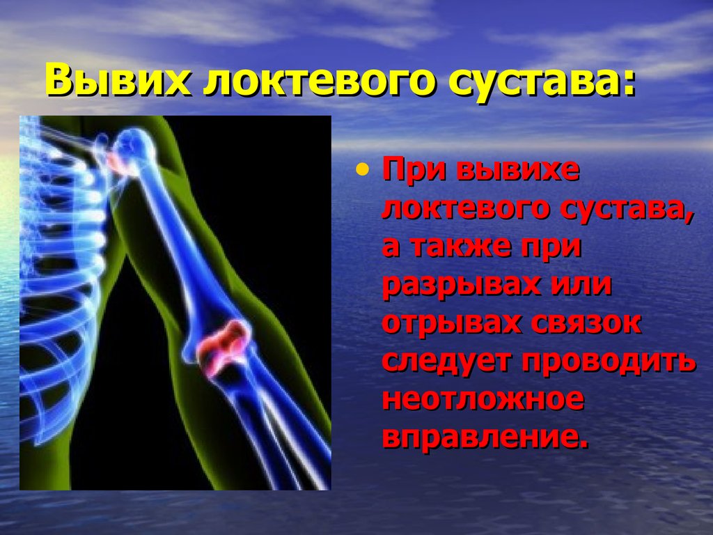 Вывих локтевого сустава. При вывихе локтевого сустава. Первая помощь при вывихе локтя. Презентация на тему локтевой сустав. Вывих локтевого сустава первая помощь.