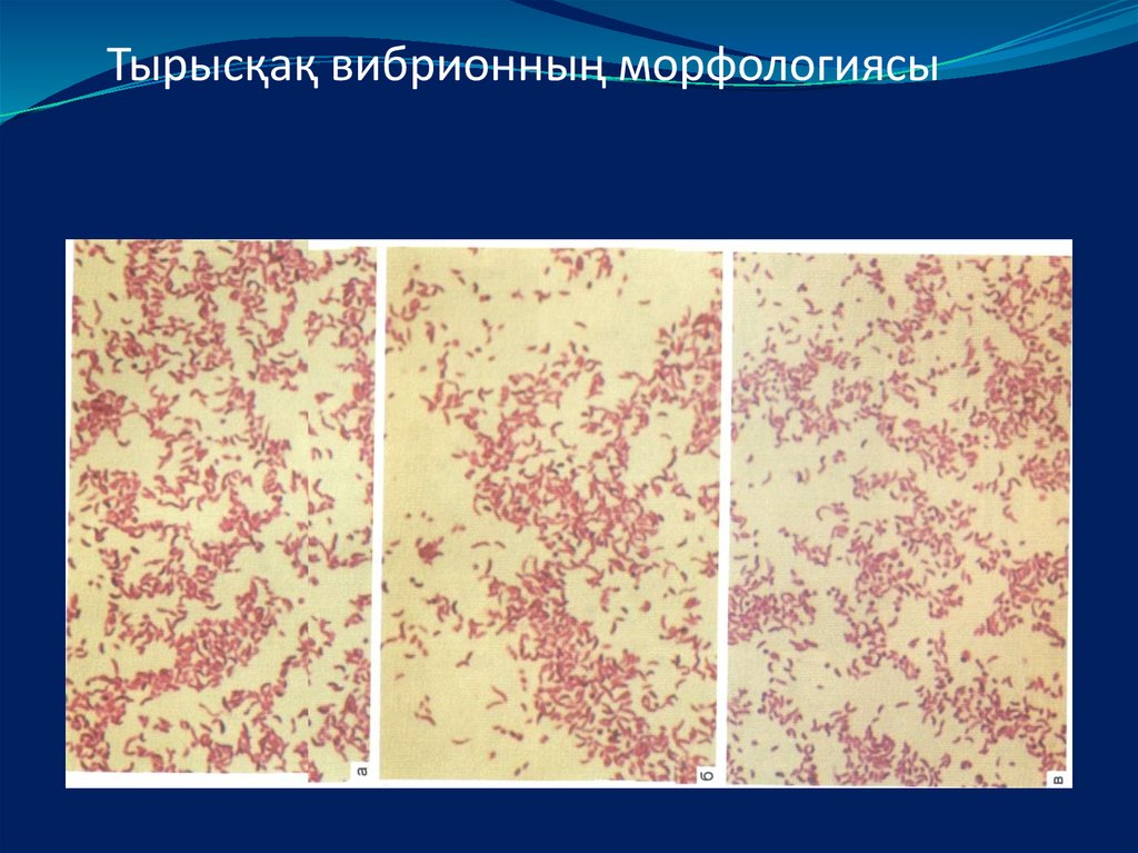 Крон ауруы презентация