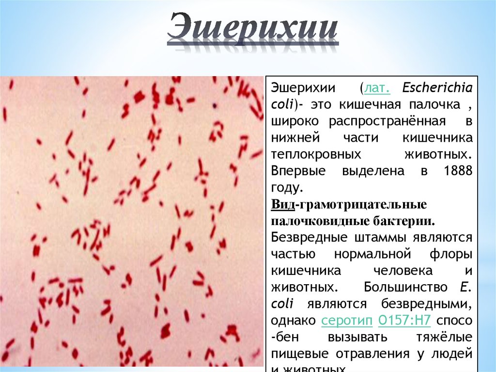 Картинка эшерихии коли