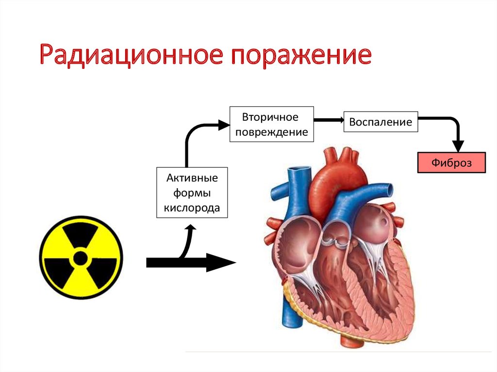 Радиационное поражение презентация