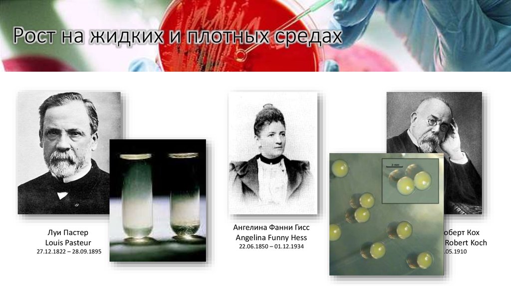 Рост на жидких и плотных средах