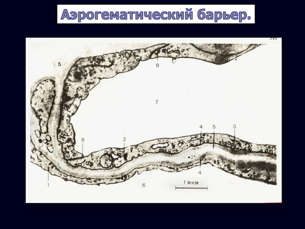 Аэрогематический барьер схема