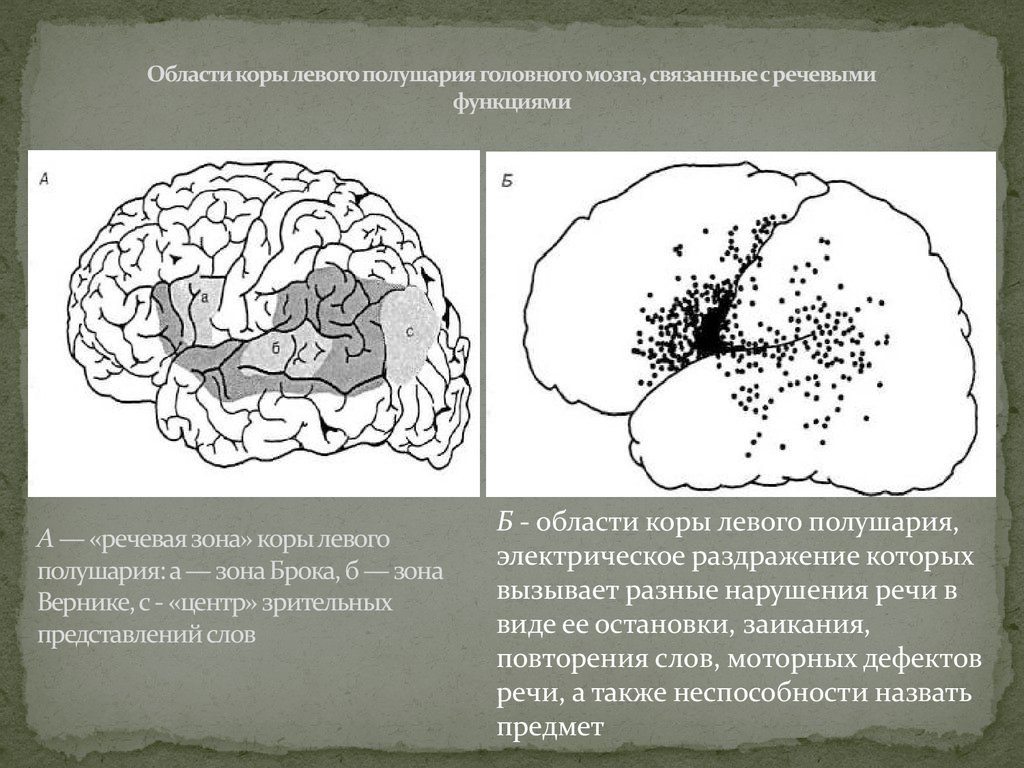 Раздражение коры головного мозга. Речевые зоны коры головного мозга. Области коры левого полушария связанные с речевыми функциями. Зоны коры левого полушария. Речевые центры коры больших полушарий.