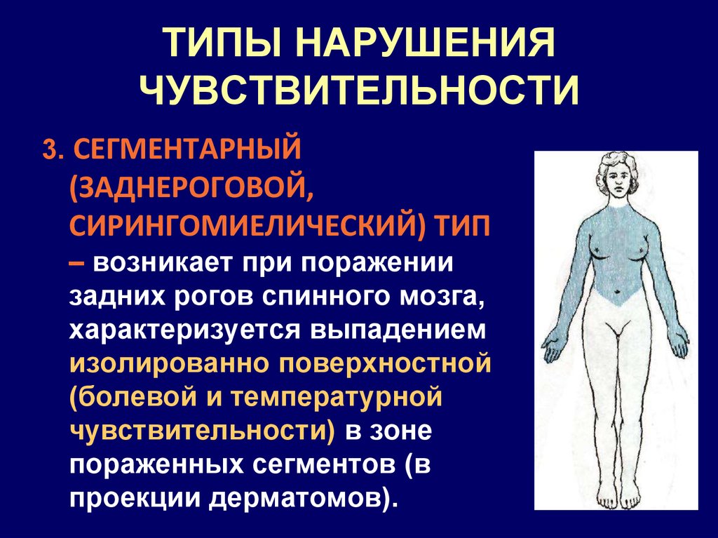 Нарушение чувствительности руки. Сегментарный Тип нарушения чувствительности. Синдромы нарушения чувствительности неврология. Сегментарный Тип нарушения чувствительности неврология. Сегментарные расстройства чувствительности возникают при поражении.