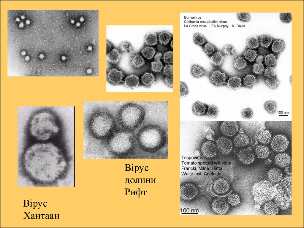 Буньявирусы микробиология презентация