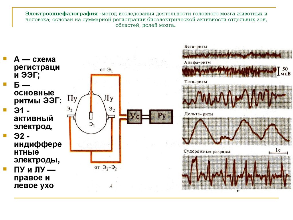 Регистрация активности мозга. .Методика электроэнцефалографии (ЭЭГ). ЭЭГ принцип метода. Ритмы головного мозга ЭЭГ физиология. Схема основных ритмов электроэнцефалограммы.