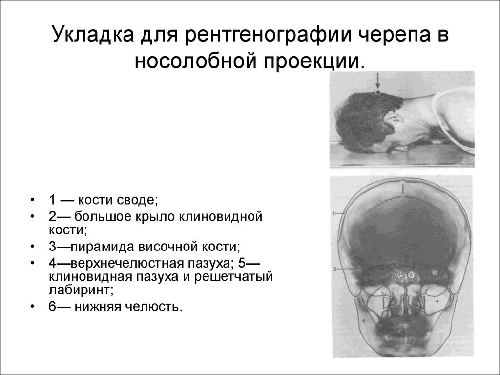 Рентген укладки в картинках