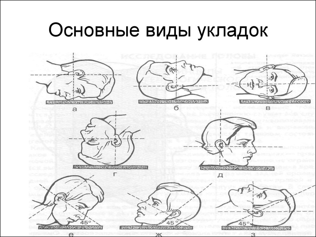 Укладки в рентгенологии в картинках и с описанием