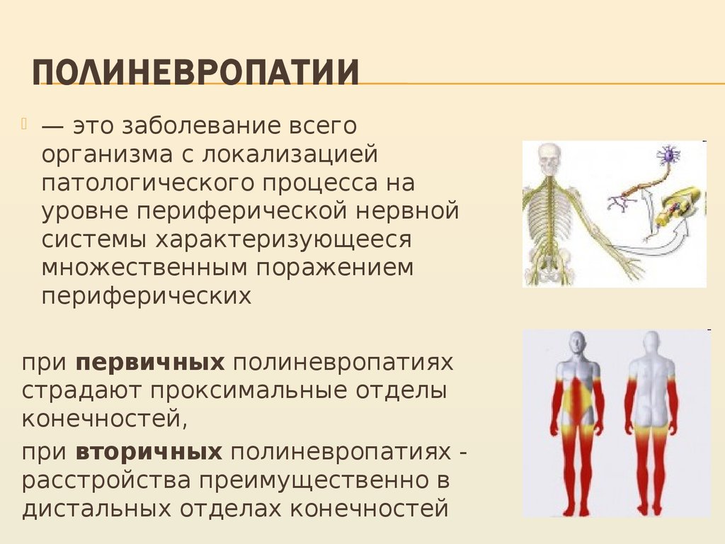 Нейропатия что это. Поражение сенсорных волокон нервов верхних конечностей. Заболевание полинейропатия. Полинейропатии неврология. Симптомы полиневропатии.