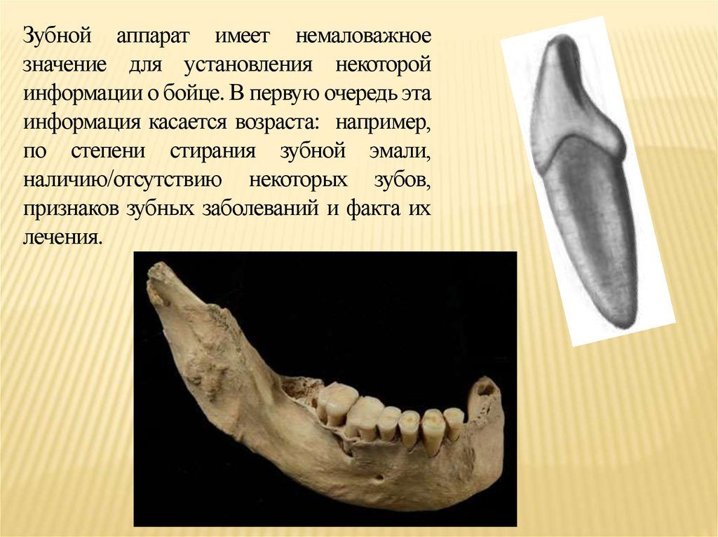 Строение зубного аппарата. Зубной аппарат человека. Строение зубного аппарата человека. Отсутствие некоторых зубов. Значение зубного аппарата.