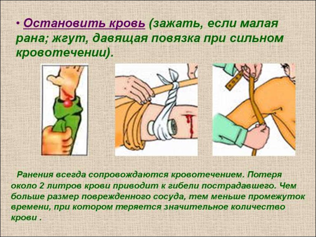 Кровотечение в домашних условиях. Как Остановить кровь из раны. Метод остановки кровотечения из раны на руке.