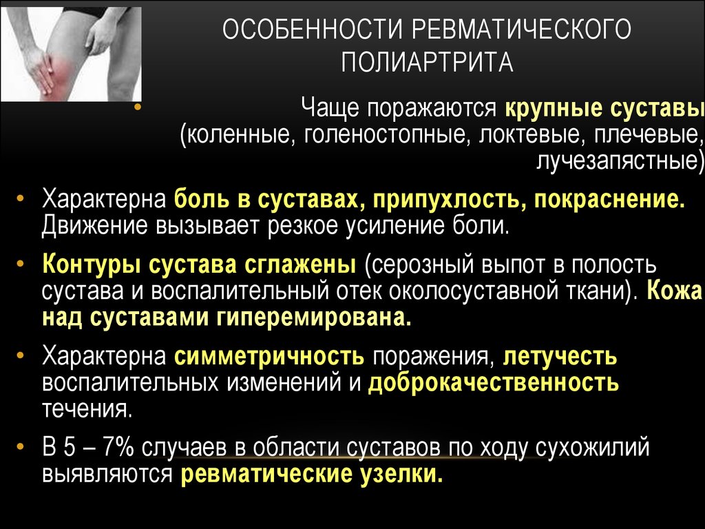 Ревматический полиартрит. Особенности ревматического полиартрита. Особенностями ревматического Полиар. Ревматоидный полиартрит характеристика. При ревматоидного полиартрита характерно.