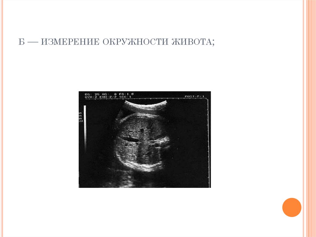 Окружность живота во время беременности