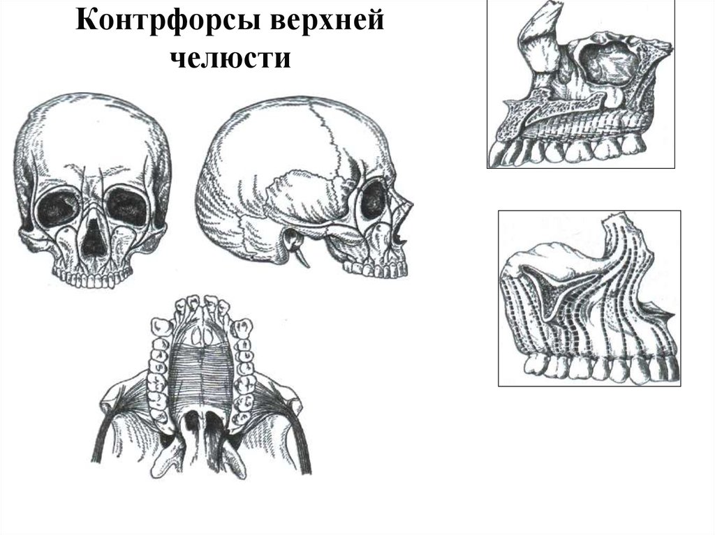 Верхний череп. Контрфорсы верхней яелю,ти. Контрофорсыверхней челюсти. Контрфорсы черепа верхней челюсти. Контрфорсы черепа нижней челюсти.