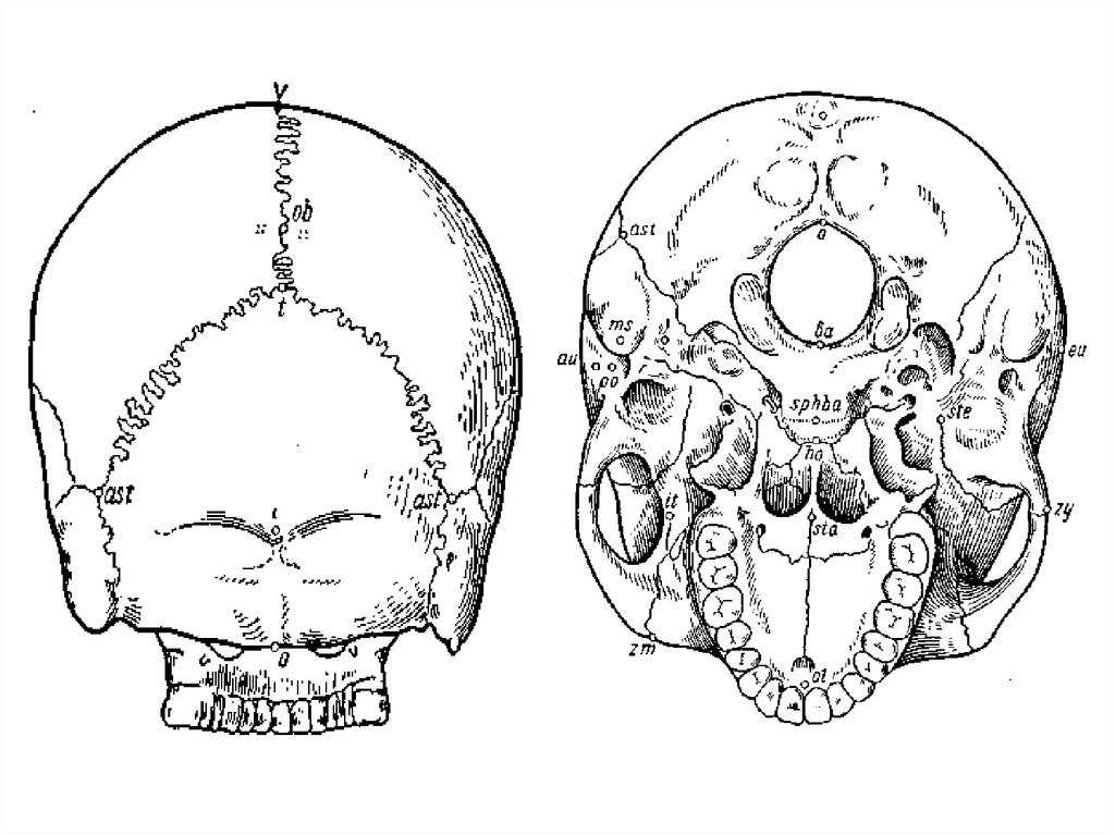 Формы черепа. Краниология учение о черепе. Неправильная форма черепа.