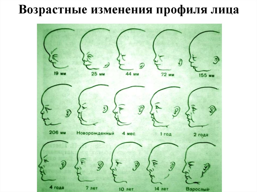 Вырасти по лицам. Форма черепа меняется с возрастом. Возрастные изменения профиля лица. Форма носа меняется с возрастом. Как меняется форма лица с возрастом.