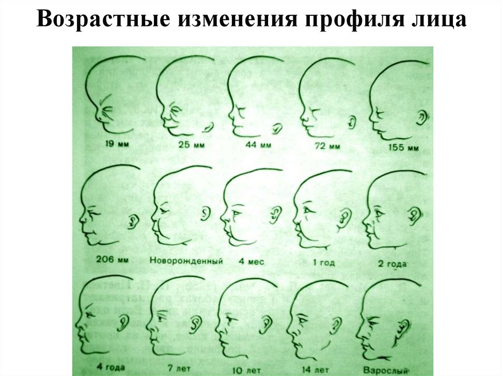 До скольки растет нос. Возрастные изменения профиля лица. Форма носа меняется с возрастом. Изменение формы носа с возрастом. Как меняется форма носа с возрастом.