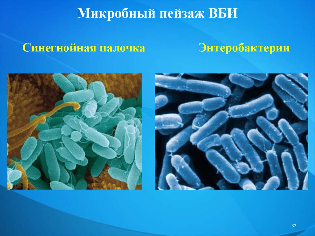 Презентация вби микробиология